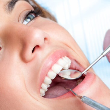 Get Straighter Teeth Faster with Six Month Smiles! – Stamford, CT