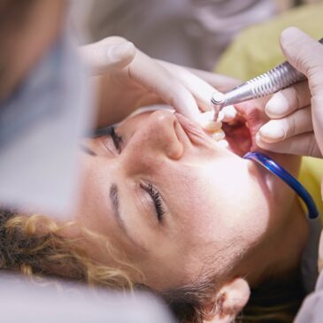 Types of dental cleaning in Stamford