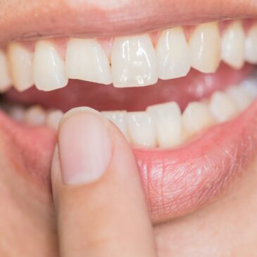 Fix a cracked or broken tooth in Stamford