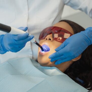 Treatment for gum pigmentation in Stamford