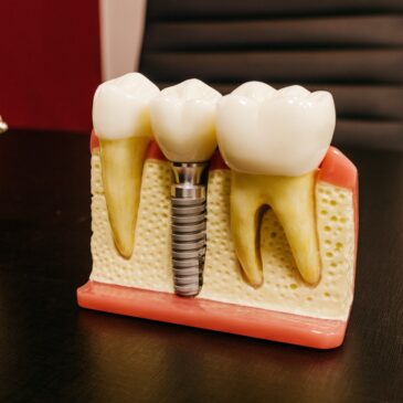 The Pros and Cons of Dental Implants: New smiles in Stamford