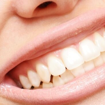 Keeping Your Mouth Fit in Stamford: Effects of Exercise and Diet