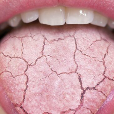 There’s nothing funny about a dry mouth in Stamford