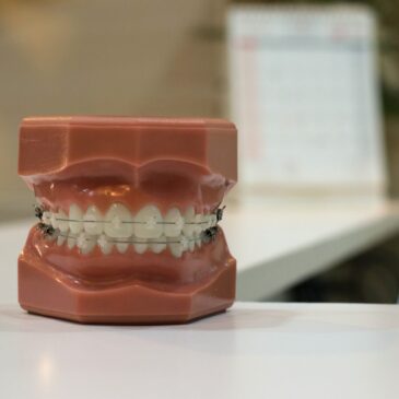Putting Your Teeth in a Glass: Dentures in Stamford