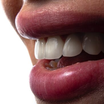 Restore Your Smile with Crown and Bridge Restorations