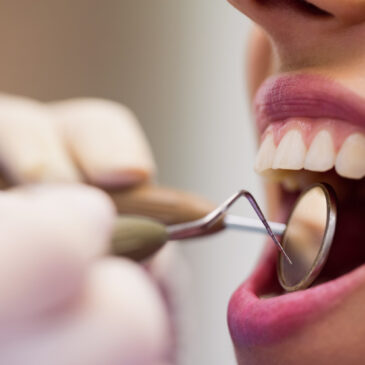 Dental Implants: Restoring Your Smile and Confidence at Stamford Dental Spa